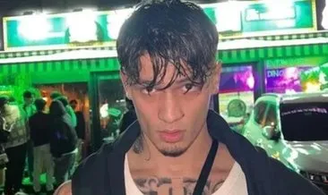 Hayranı Çakal’ı ayağından vurdu #tekirdag