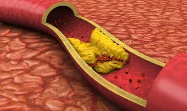 Kolesterolün önemi kanda ortaya çıktı: Düşükte kan berrak, yüksekte bulanık ve katı