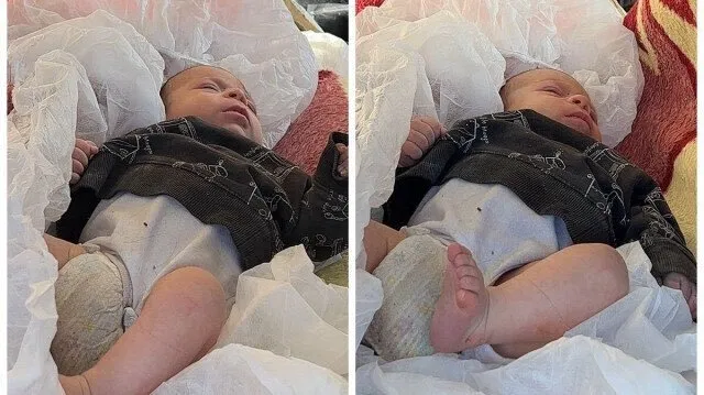 SON DAKİKA: Deprem sonrası mucize kurtuluşlar! Gözyaşları sel olup aktı!