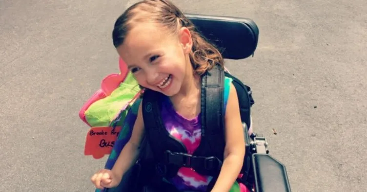 Serebral palsi nedir, tedavisi nasıl yapılır? Serebral palsi beyin felci belirtileri ve nedenleri nelerdir?