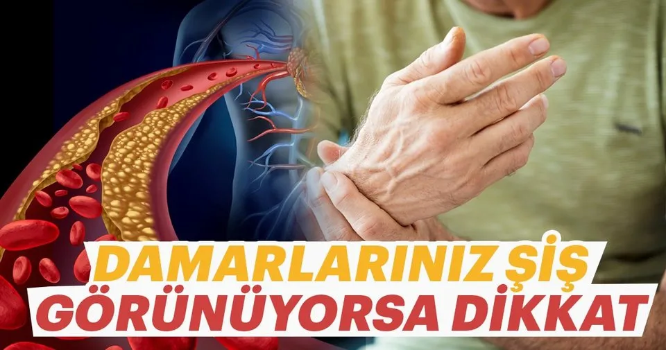 vucuttaki damarlarin belirginlesmesinin nedenleri aktuel haberleri