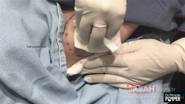 Operasyonla aldırdı gözlerine inanamadı!
