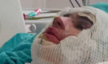 Bu nasıl amca! Yeğeninin üzerine benzin döküp çakmağı çaktı!
