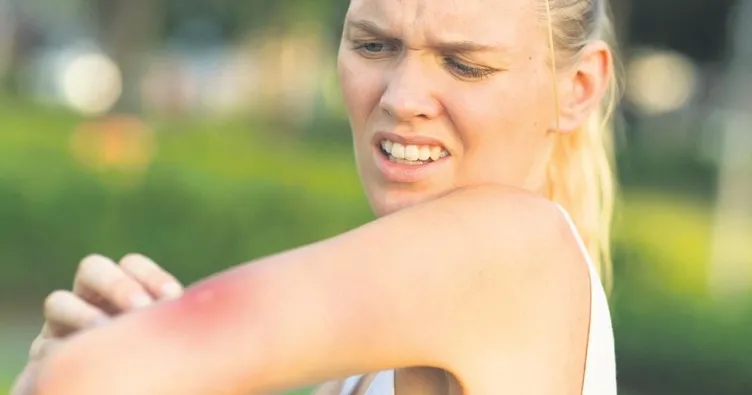 Sivrisinek ısırıkları neden geçmez?