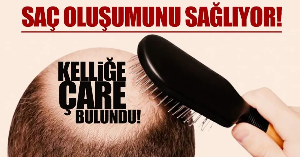 18 Gunde Sac Cikaran