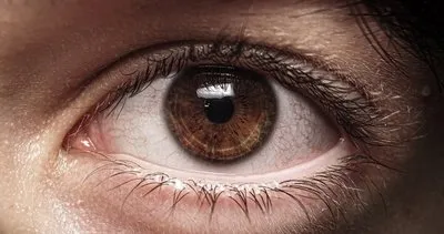 Dünyaca ünlü göz cerrahı Dr. Mearza’dan açıklama! Koyu renk gözlüyseniz dikkat: Bu hastalık yakanızda...