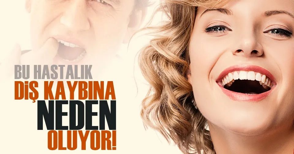 Bu Hastalik Dis Kaybina Neden Oluyor Son Dakika Haberler