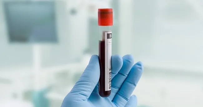 https www sabah com tr saglik 2020 07 23 rbc nedir kan tahlilinde rbc dusuklugu ve yuksekligi ne anlama gelir s1