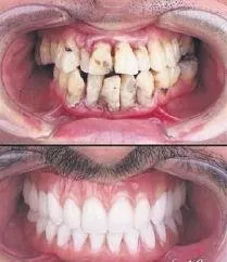 dis yaptirirken emniyet kemerinizi