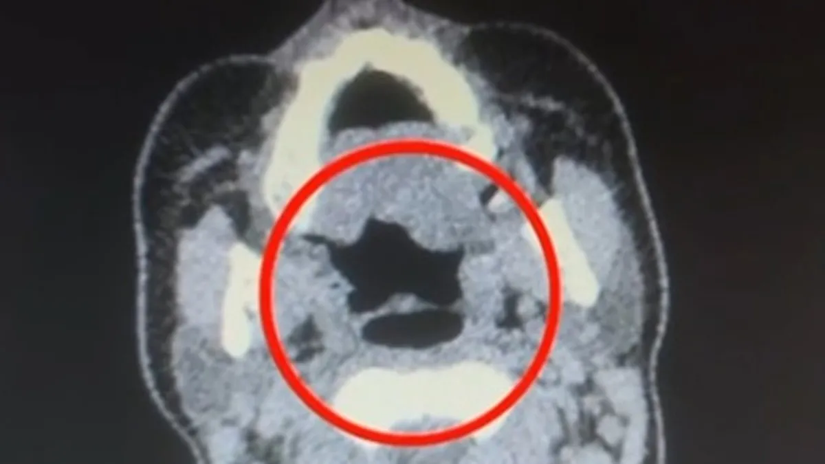 Kayseri’de uyuşturucu operasyonu: Midesinden yarım kilo çıktı! Kayseri’de uyuşturucu operasyonu: Midesinden yarım kilo çıktı!