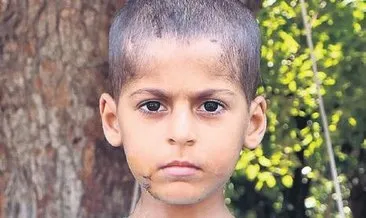 Köpek saldırısına uğrayan Casim taburcu oldu #adana