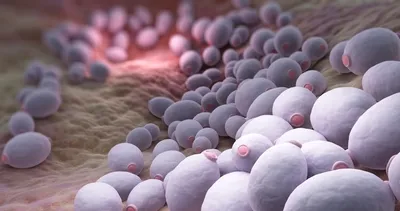 Candida diyeti nedir? Candida diyeti nasıl yapılır?