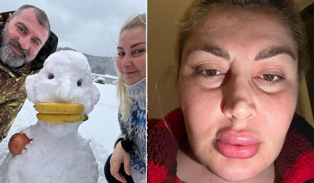 Atik Ailesi’nden Burcu Atik hastalığını açıkladı En son kampta