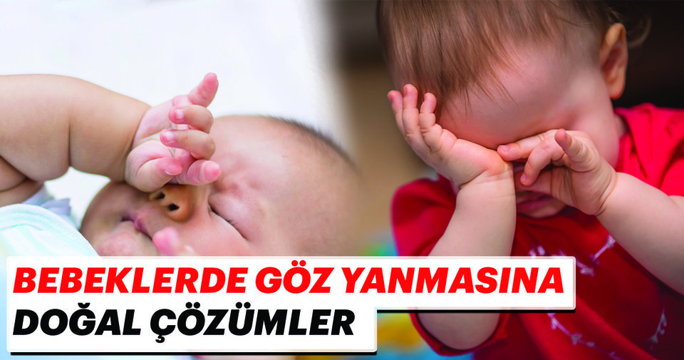 bebeklerde goz yanmasina dogal cozumler bebek haberleri