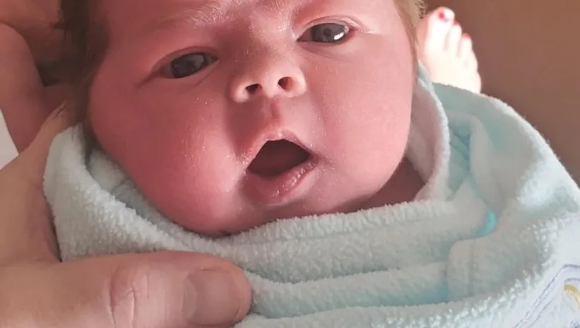 Neden bazı bebekler saçlı, bazıları saçsız doğar?