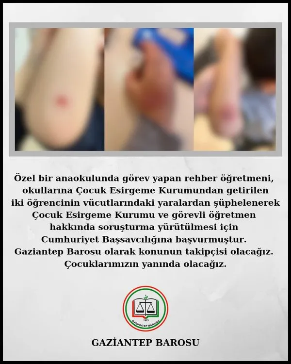 gaziantepte-yurttaki-cocuklara-iskence-iddiasi-1-bakim-personeli-gozaltina-alindi-1732365153905.jpg
