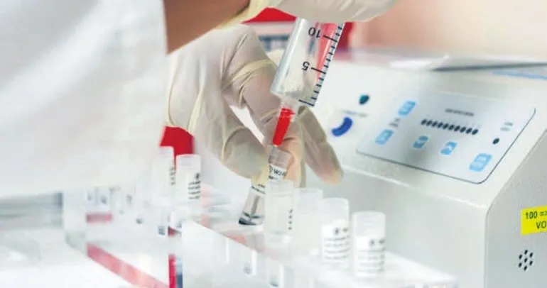 Kök hücre naklinde dünyada ilk 5’teyiz