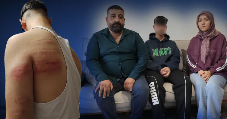 Niğde’de 15 yaşındaki berber çırağına demir sopalı darp iddiası: Hem dövdü hem video çektirdi
