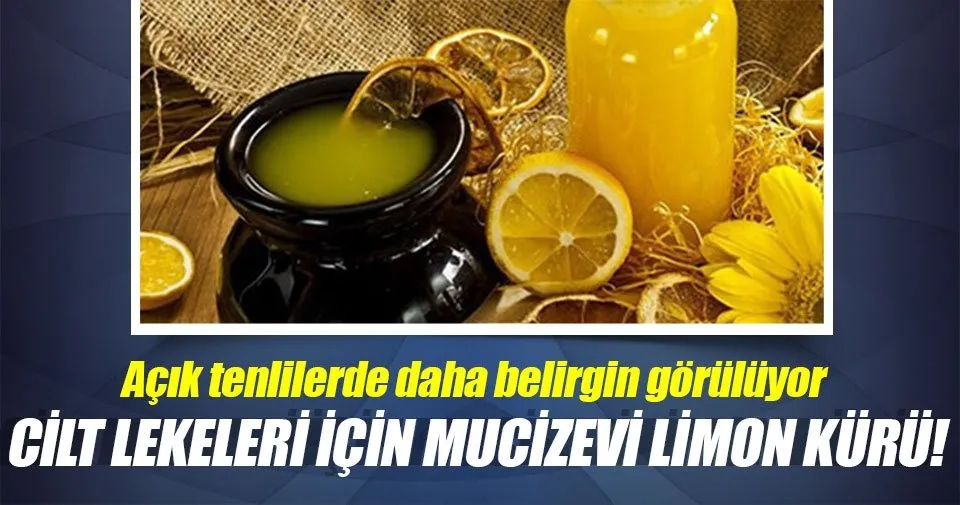 Cilt lekeleri için mucizevi limon kürü! Kadın Haberleri