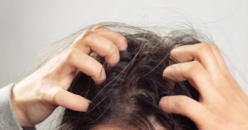 sac diplerindeki kasintiya ne iyi gelir sac dipleri neden kasinir saglik haberleri