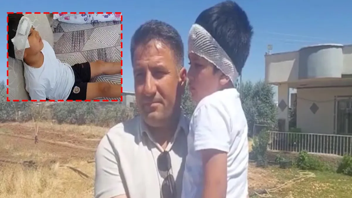 Şanlıurfa Viranşehir'de köpek saldırısı olayı