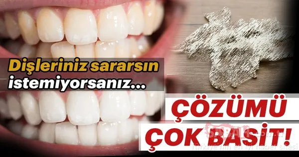 Dişleriniz sararsın istemiyorsanız...