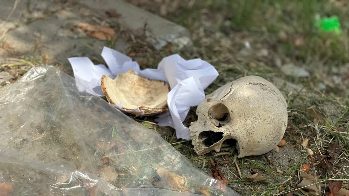 Çöpte bulunan kafatasının sır perdesi aralandı: Doktor 31 yıl önce öğrenciyken mezarlıktan eğitim için almış
