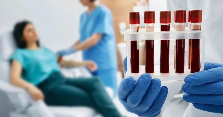 Alzheimer teşhisinde devrim