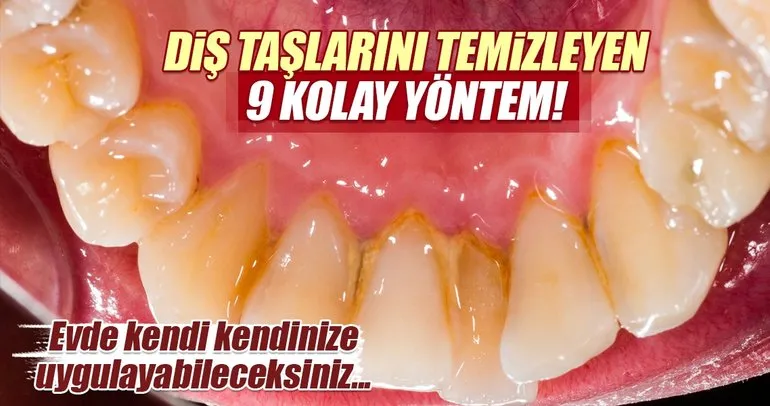 dis taslarini temizleyen 9 kolay yontem galeri saglik