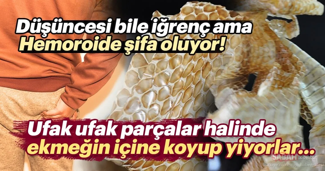 hemoroide sifa oluyor ufak ufak