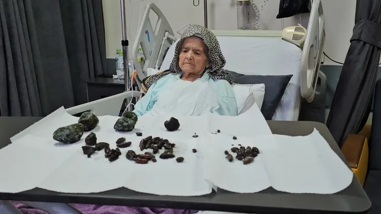 Doktorlar şoke oldu: 92 yaşındaki kadının midesinden ve bağırsaklarından neler çıktı neler!