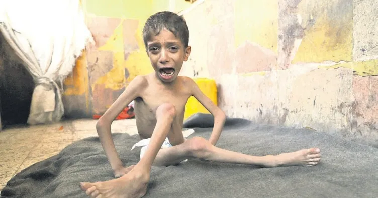 İnsanlığın vicdanı Gazze’de donuyor