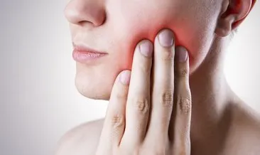 Diş apsesi nasıl geçer, bitkisel tedavi nasıl yapılır? Diş apsesine iyi gelen doğal antibiyotik önerileri