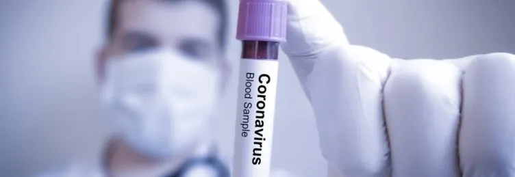 SON DAKİKA! Koronavirüs geçirmiş olabilirsiniz… O belirtilere dikkat!