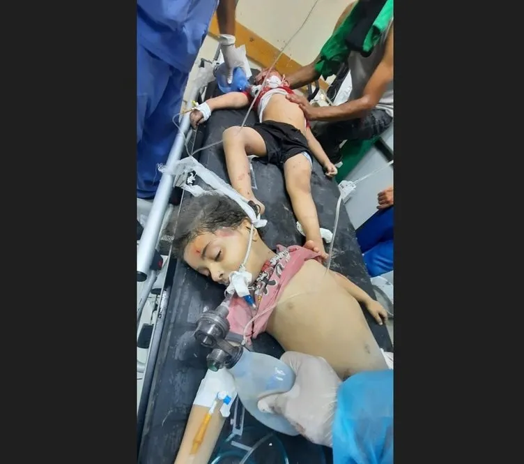 Gazzeli doktor yaşanan dehşeti SABAH’a anlattı: “Vücutları yanmış çocuklar geliyor”