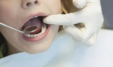 Diş Taşı Temizliği Acıtır Mı? Diş Taşı Temizliğinde Diş Uyuşturulur Mu, Can Yakar Mı?