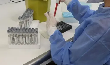 ABD’de jalapeno biberi salgın çıkardı