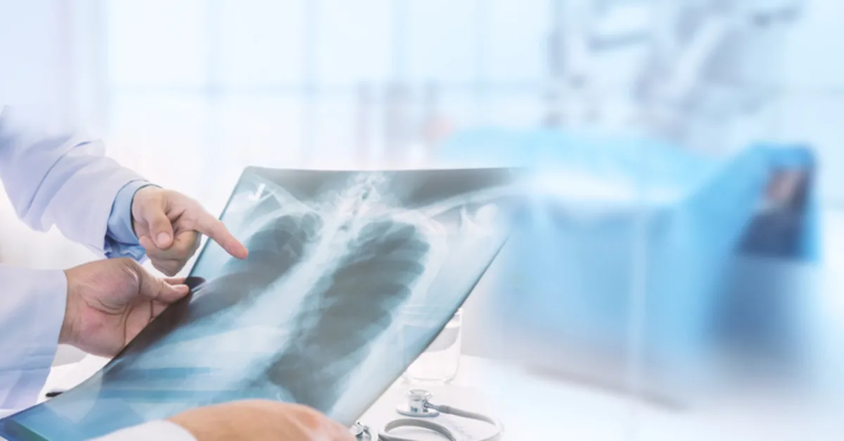 zaturreye ne iyi gelir zaturre bulasici midir ve evde dogal tedavisi nasil yapilir saglik haberleri zaturreye ne iyi gelir zaturre bulasici midir ve evde dogal tedavisi nasil yapilir saglik haberleri