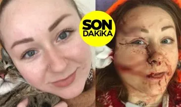 SON DAKİKA: Boşanmak isteyen Ukraynalı Anna Butim’in yüzünü falçatayla parçaladı! Mesut Öztürkmen tutuklandı