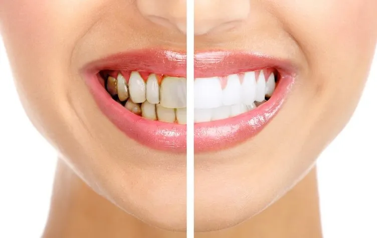 Ağız ve diş bakımında doğru bilinen 10 yanlış