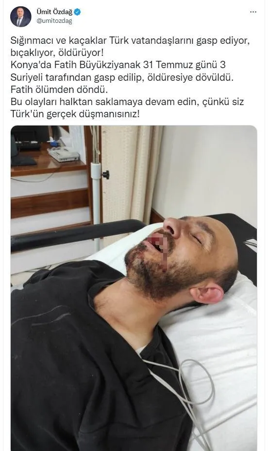 umit-ozdag-provokasyon-yapti-kendi-kazdi-kuyuya-dustu-1659772154402.jpg