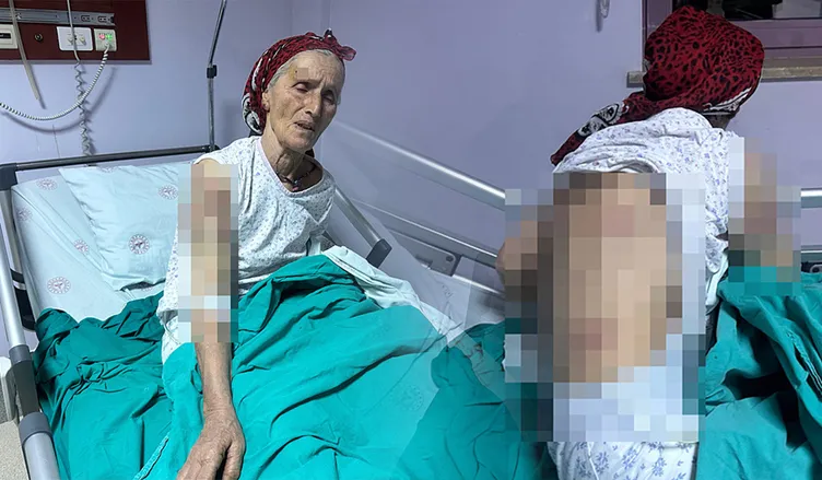 SON DAKİKA... 7 sokak köpeği 65 yaşındaki kadını parçaladı: Vücuduna tam 50 dikiş atıldı!