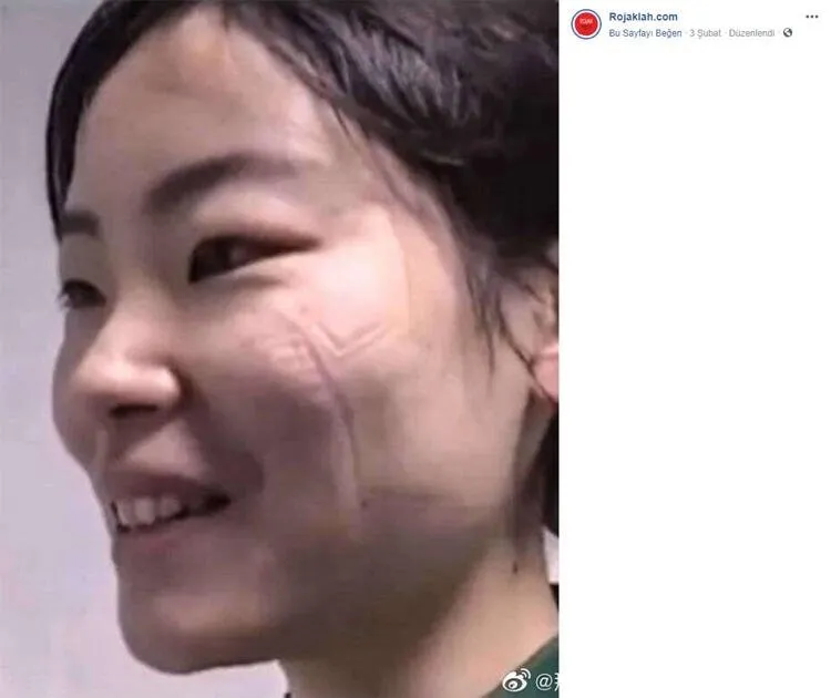 Koronavirüs ile mücadelenin izleri günlerce konuşulmuştu! Acı haberi duyurdular