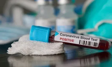 E-devlet şifresi ile  E-Nabız girişi, covid test sonucu sorgulama ve aşı randevusu: Koronavirüs test sonucu e-nabızla nasıl öğrenilir?