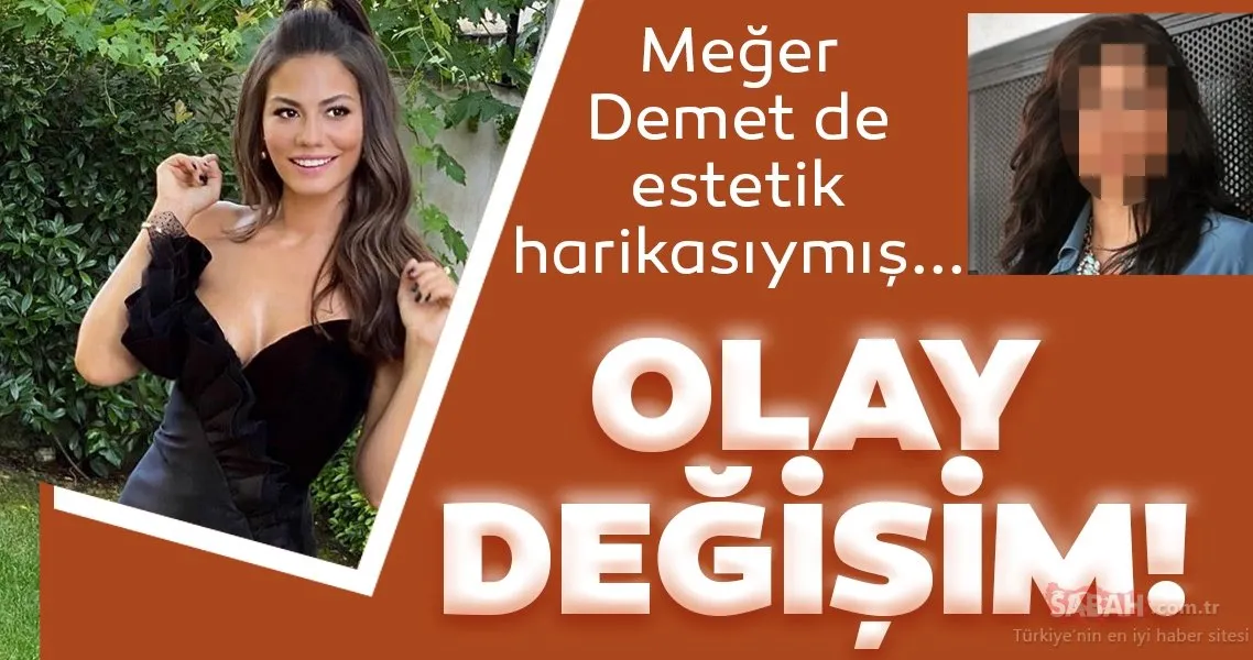Doğduğun Ev Kaderindir�in Zeynep�i Demet Özdemir de estetik harikası