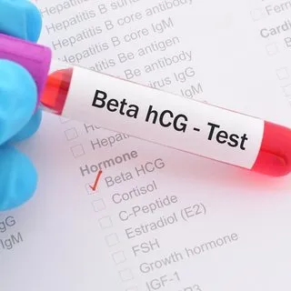 Beta hCG hesaplama: Beta hCG değeri kaç olmalı?