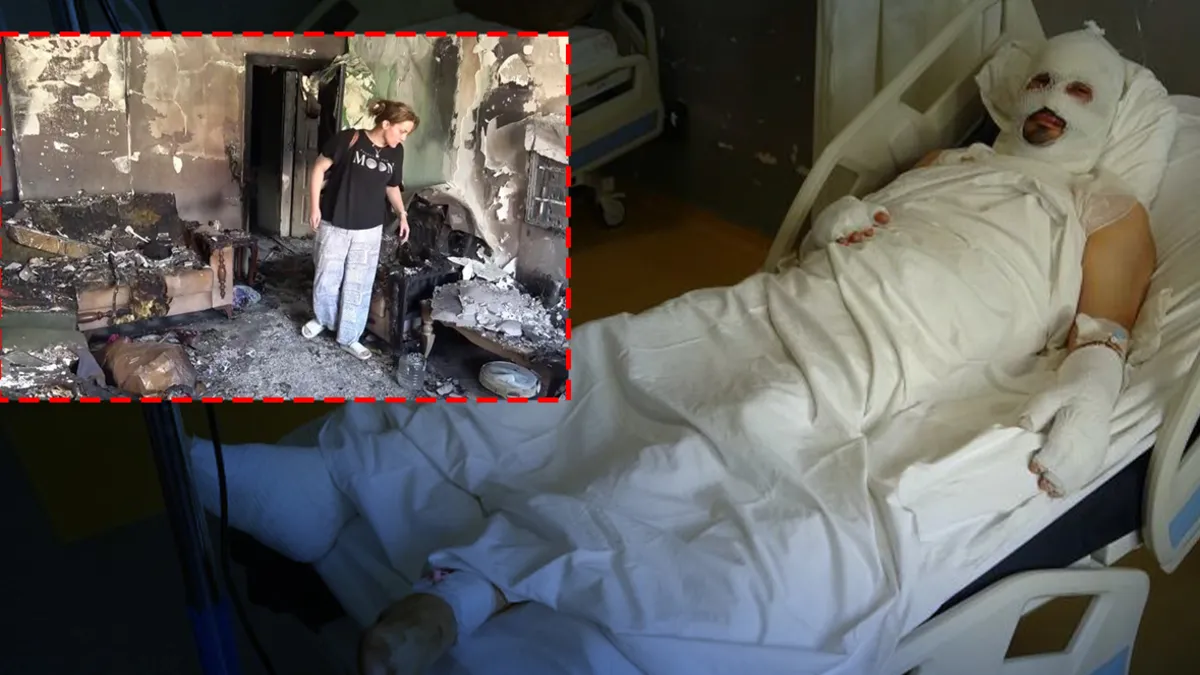 Hatay’da alevlerin arasında ailesini kurtarmak isterken ağır yaralandı: Lamba ile telefon aynı anda patladı!”
