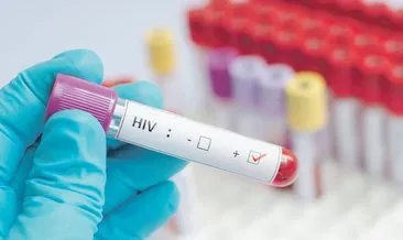 HIV virüsü taşıdığını eşinden gizledi