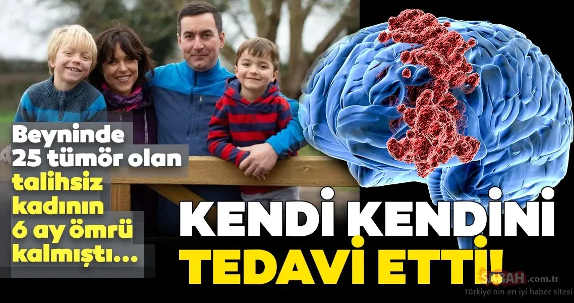 Sadece 6 Ay Omrun Kaldi Demislerdi Beynindeki 25 Tumoru Kendi Tedavi Etti Son Dakika Haberler