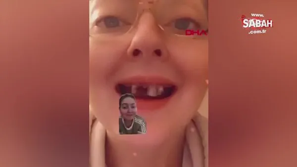 ABD'de 10 yıldır aşırı soda tüketen genç kızın dişleri döküldü | Video